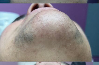 ✨4 You Studio Láser✨